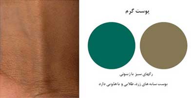 رنگ پوست ,انواع پوست