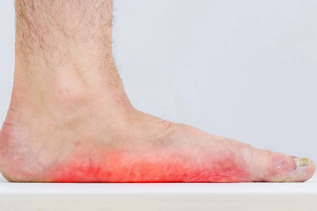 مشکلات رایج پا در افراد مسن, خستگی پا در افراد مسن