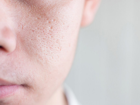 راهنمای خرید پرایمر, نحوه مقایسه ی پرایمر, منافذ پوست