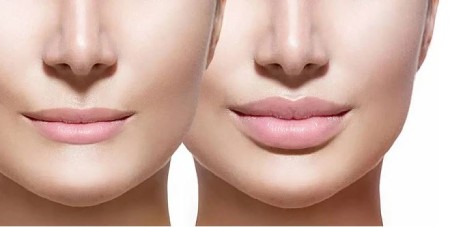 رفع افتادگی گوشه لب با آرایش