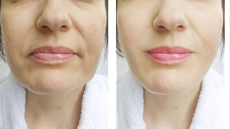 آرایش لب آویزان