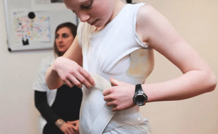 جلوگیری از اسکولیوز, پیشگیری از اسکولیوز