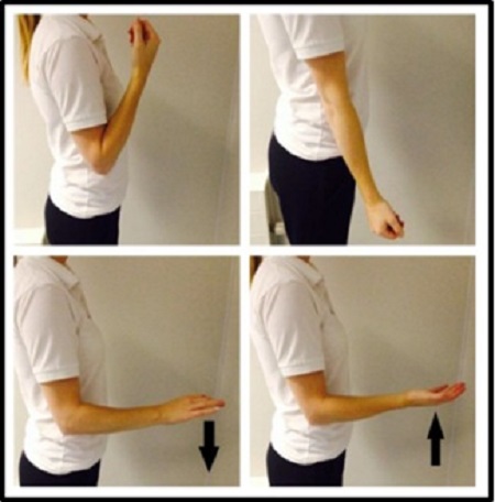 انواع شکستگی استخوان آرنج, تمرینات ورزشی پس از درمان شکستگی آرنج, حرکات اصلاحی برای درمان شکستگی آرنج