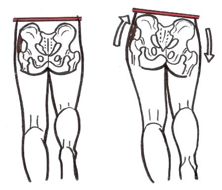 عدم تعادل در قدرت عضلانی در مناطق تحتانی بدن