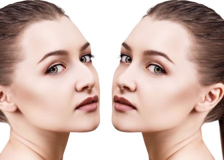 کوچک کردن بینی با یخ در خانه