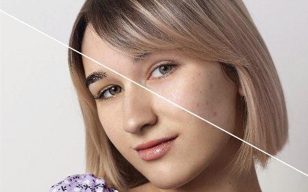 آیا استفاده از تونر موجب ایجاد جوش می شود؟