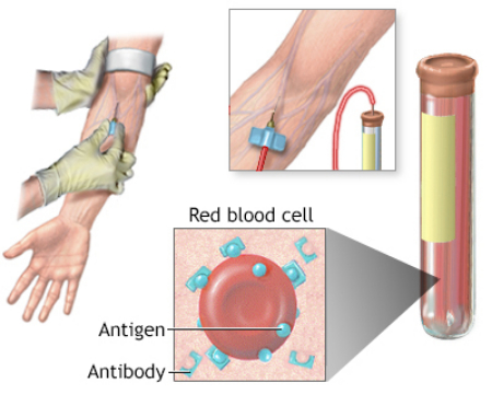 تست آنتی‌بادی, نحوه انجام آزمایش تیتر آنتی بادی
