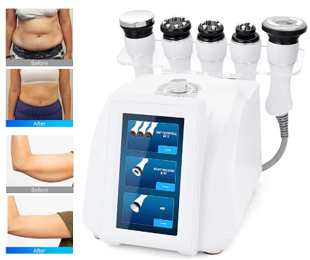 روند جراحی بادی کانتورینگ, دوره نقاهت بعد از بادی کانتورینگ 360 درجه