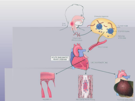 تب روماتیسمی, آزمایش تب روماتیسمی