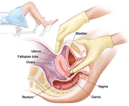 نئوپلازی داخل اپیتلیال وولو, راههای تشخیص VIN 