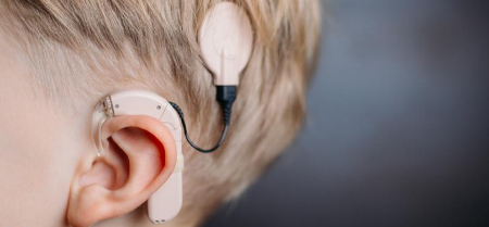 کاشت حلزون گوش, ایمپلنت حلزون گوش