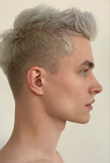 مدل جراحی بینی طبیعی, مدل جراحی بینی طبیعی برای بینی استخوانی