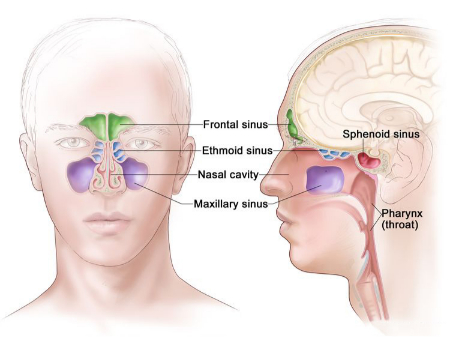 سرطان بینی, سرطان سینوس