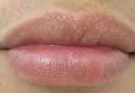 نقاط فوردایس لب چیست