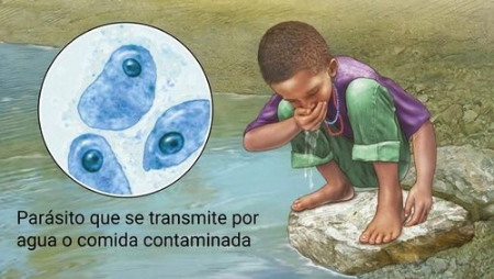 آمیبیازیس, آمیبیازیس خارج روده ای, تشخیص آمیبیازیس