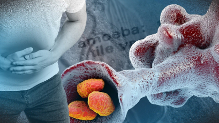 آمیبیازیس, آمیبیازیس خارج روده ای, تشخیص آمیبیازیس