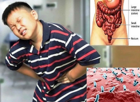 آمیبیازیس, آمیبیازیس خارج روده ای, تشخیص آمیبیازیس