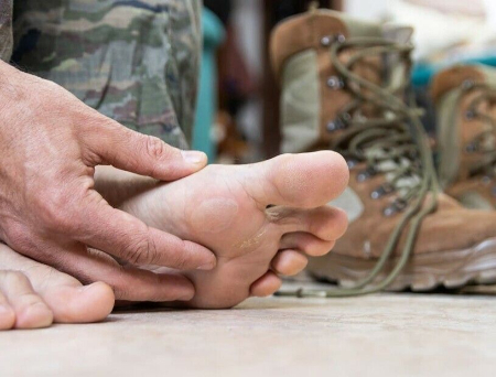 پای سنگرمانده, بیماری پای سربازان