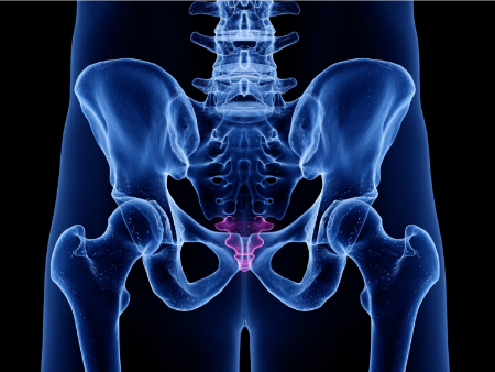 آرتریت دنبالچه, درمان التهاب دنبالچه