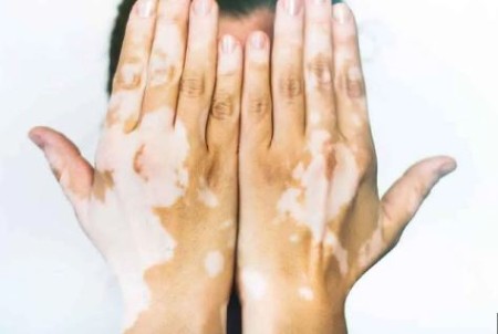 سلول‌های بنیادی