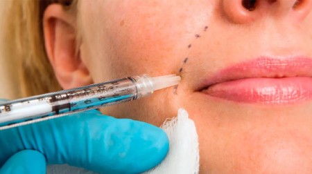 تخلیه ژل پاژ