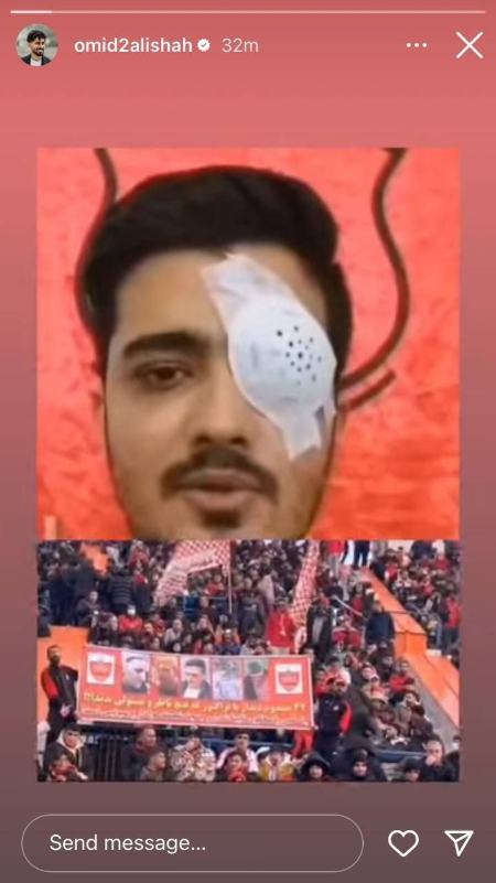 دیدار پرسپولیس و تراکتور،اخبار ورزشی،خبرهای ورزشی