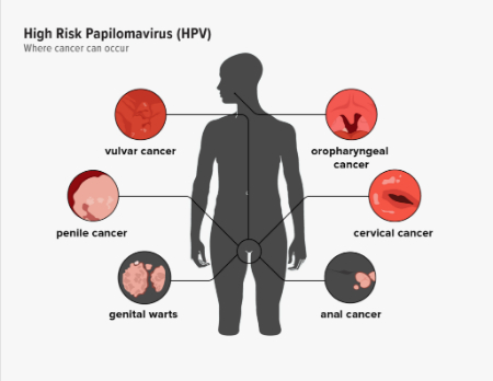 HPV در مردان چیست, خطر HPV برای مردان