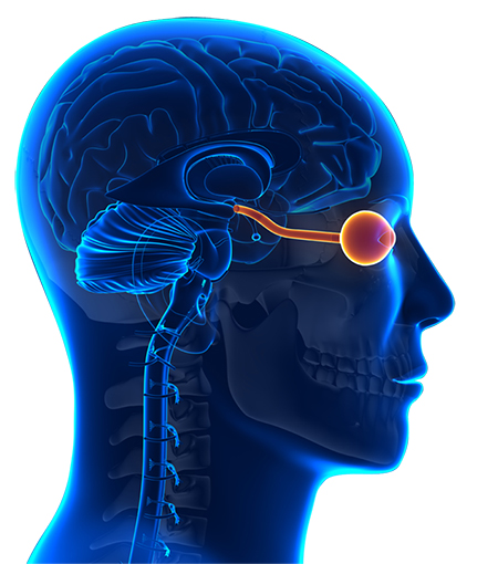 بیماری نورومیلیت اپتیکا, تشخیص نورومیلیت اپتیکا