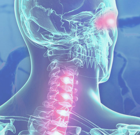 بیماری نورومیلیت اپتیکا, تشخیص نورومیلیت اپتیکا