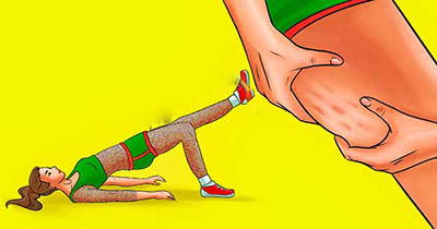 کاهش سلولیت