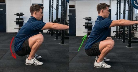 چرخش لگن به داخل, قوز لگن, قوز لگن چیست