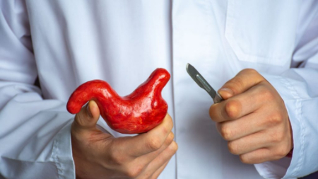 رژیم لاغری یا جراحی لاغری, جراحی لاغری بهتر است یا رژیم