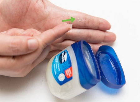 پاک کردن چسب قطره‌ای از پوست , حذف چسب قطره‌ای از دست