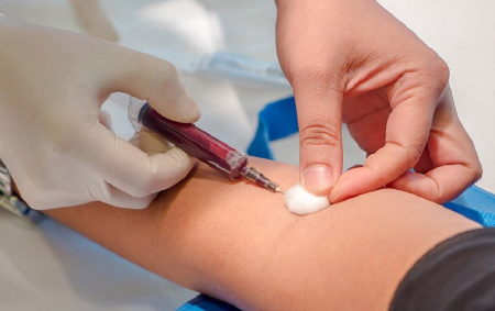 آزمایش LDH چیست, آزمایش LDH و سرطان 