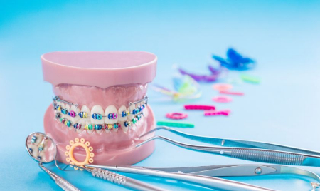 انواع روش‌های ارتودنسی, بهترین روش ارتودنسی