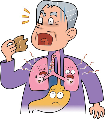 پنومونی آسپیراسیون, پیشگیری از پنومونی آسپیراسیون