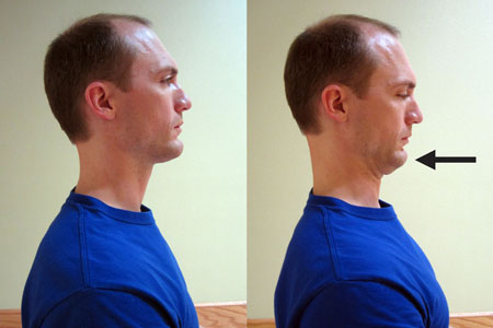 ورزش گردن درد, ورزش برای گردن درد, درمان گردن درد با ورزش