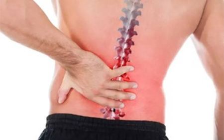 درمان دیسک کمر