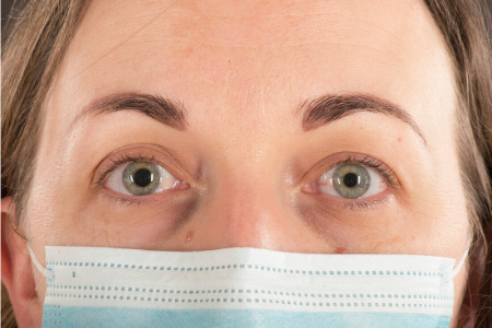 سندرم آدی, مردمک تونیک