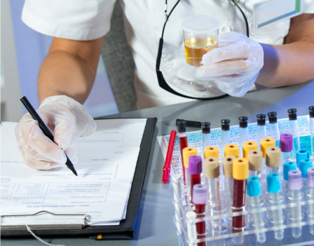 آزمایش کورتیزول چیست, آزمایش کورتیزول ادرار