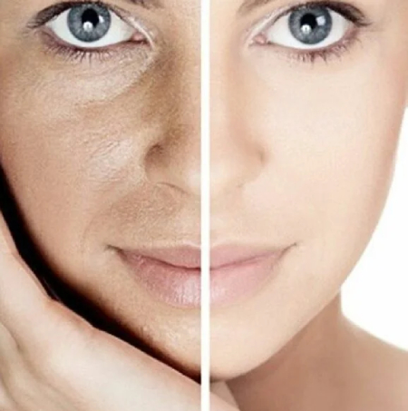 علت کم‌آبی پوست صورت