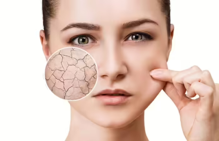 علت کم‌آبی پوست صورت