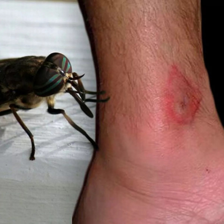 گزیدگی مگس اسب, عفونت گزیدگی مگس اسب