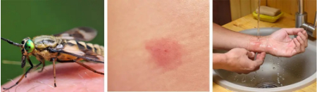 گزیدگی مگس اسب, عفونت گزیدگی مگس اسب