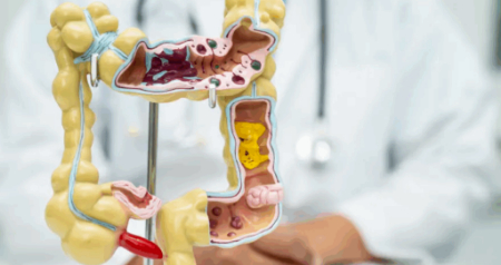 نشانه های هشداردهنده آسیب به روده, باکتری‌های خوب روده