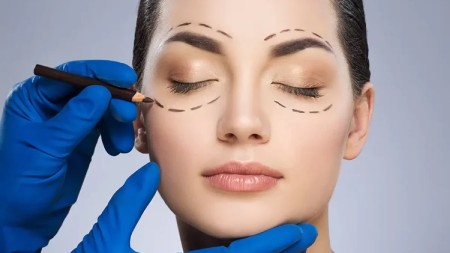 عمل چشم گربه ای