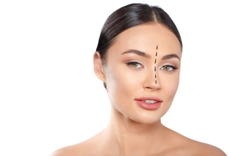 جراحی بینی گوشتی, جراحی بینی استخوانی