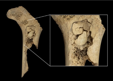  آدم‌خواری در اسپانیا ,اخبارگوناگون,خبرهای گوناگون 