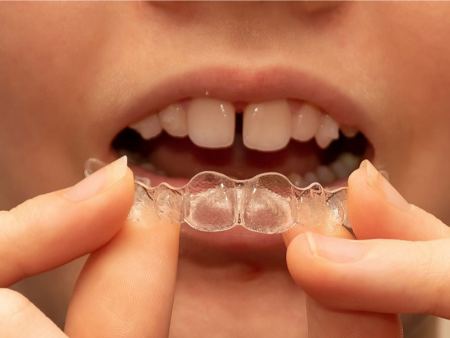 ارتودنسی متحرک