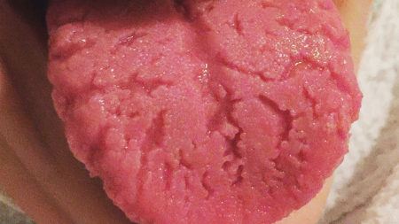 زبان شیاردار, بهداشت زبان شیاردار